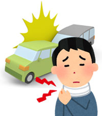 むちうち症
